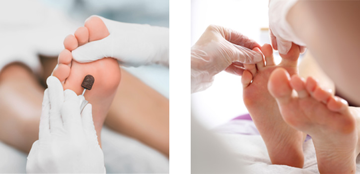 Skin and nails foot care